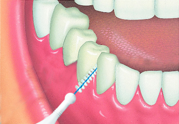 cepillo interdental.jpg